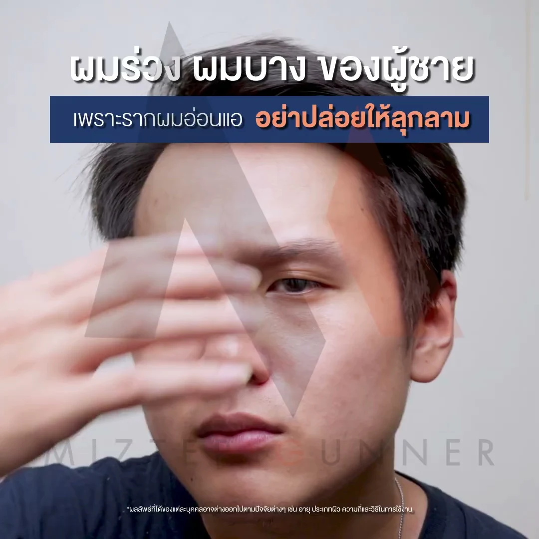 ภาพตัวอย่างวิดีโอ Smooth E Hair Men